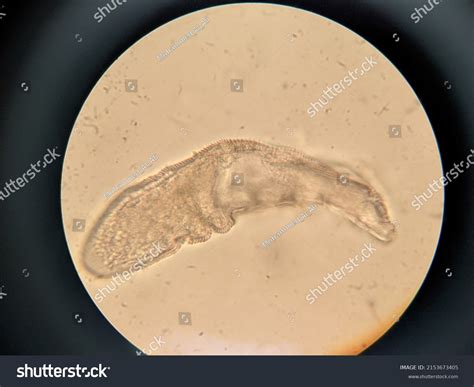 Photo Demodex Face Mites Under Microscope Stock Photo 2153673405 ...