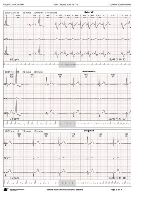 Przykładowe wyniki badań HolterHELP badania Holterem EKG