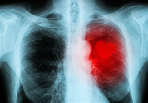 Organ Paru Paru Kenali Bagian Dan Fungsinya Di Sini