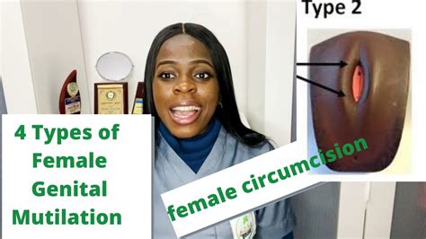 Female Circumcision Type 4