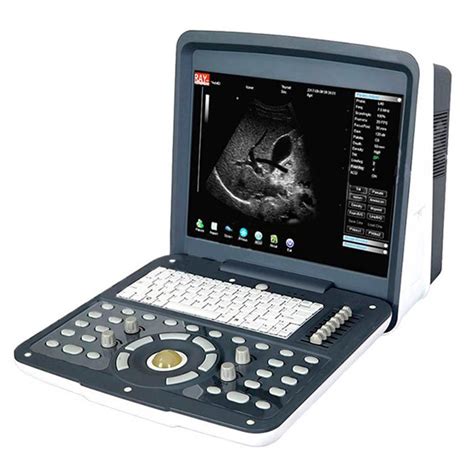 Переносной УЗИ-сканер AcuVista RS880d › Купить оптом и в розницу › Цена ...