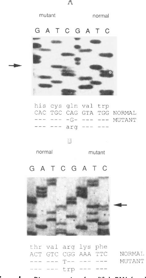 Galactose 1 Phosphate Semantic Scholar