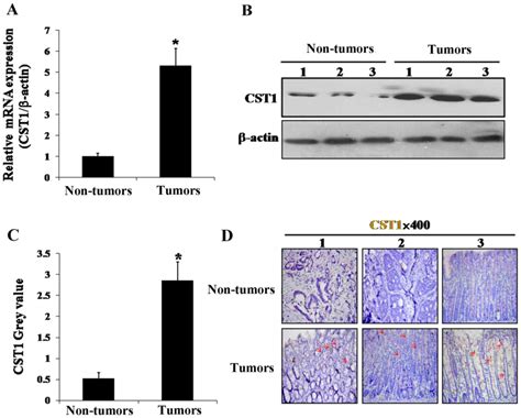 Let‑7d Inhibits Colorectal Cancer Cell Proliferation Through The Cst1