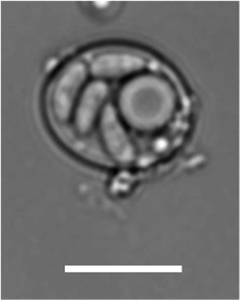 Sporocyst Of Sarcocystis Sp Shed By A Common Boa Boa Constrictor In