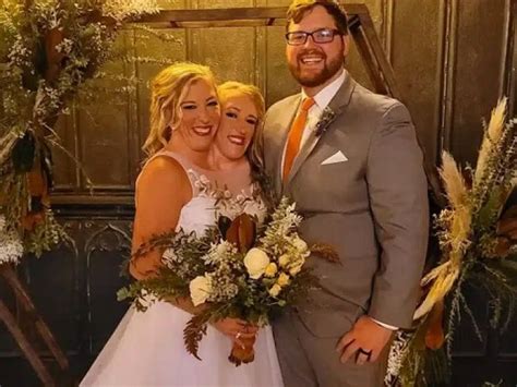 Popular American conjoined twin gets married (Photos) – The Pathfinder