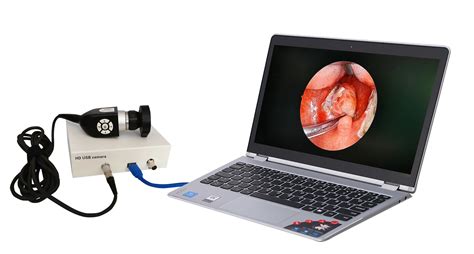 Hd Medical Portable Camera System Endoscopy Camera With Led Cold