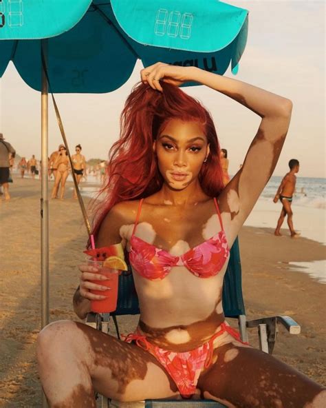 Winnie Harlow Spread Her Legs Wide In Tiny Bikini 21 Photos The Fappening