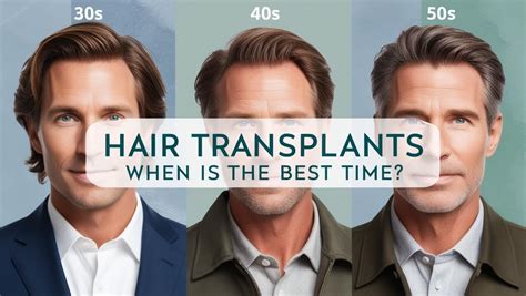 age   hair transplant     expert insights