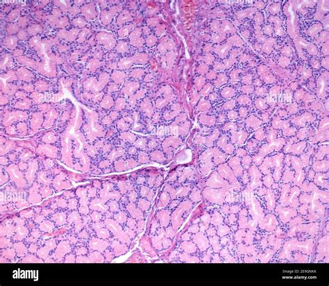 Brunner glands of the duodenum with their typical appearance of ...