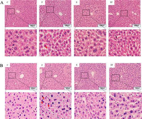 The He Staining Diagram Of The Liver In Mice From The Group C F E Download Scientific