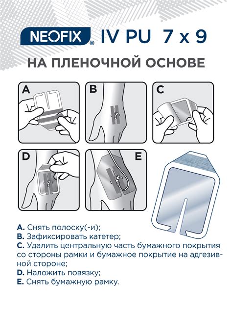NEOFIX® IV PU - АТЕКС ГРУПП
