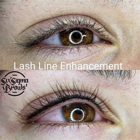 lash line enhancement