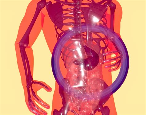 Internal Iliac Artery Stenosis - Diagnosis And Management