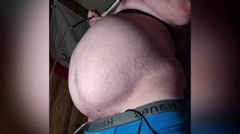 Sixty One Belly Inflation Pornhub Gay