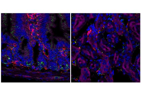 Limp Scarb E Z F Rabbit Mab Cell Signaling Technology