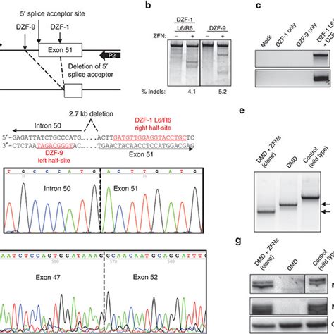 Restoration Of The Dystrophin Reading Frame In Dmd Patient Myoblasts