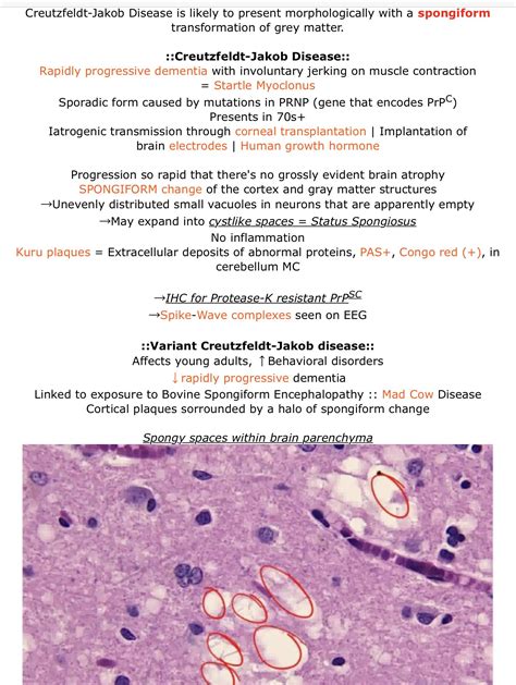 Has anyone used an Anki deck other than Anking recently? 📷 : r
