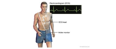 24 Hour Holter Monitor - One Heart Cardiology