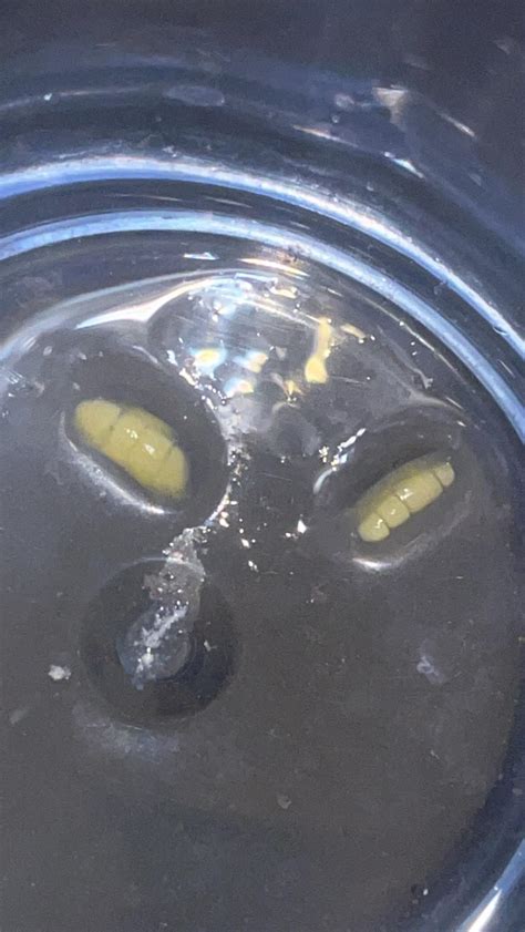 Tapeworm Segments or White Rice? : r/parasites