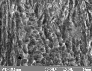 Microstructure of steel 15Kh2MFA( ІІ ): a, b – bainitic-martensitic ...