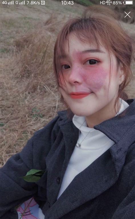 Hot girl với vết chàm lớn trên mặt trở thành mẫu lookbook nổi tiếng Con gái xinh nhất khi tự