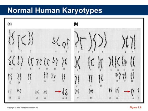 Melc Sex Determination Sex Chromosomes Ppt Explain The Different Patterns Of Non Mendelian