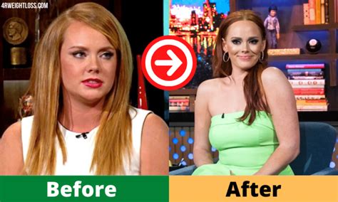 Kathryn Dennis Weight Loss 2024 Diet Surgery Before And After Photos