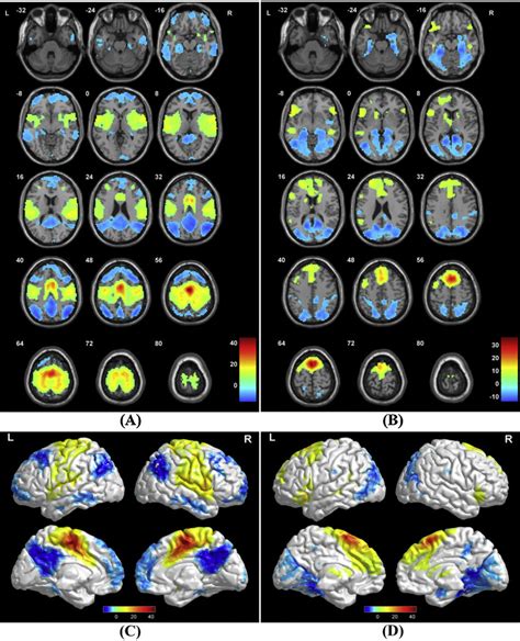 Group Level Functional Connectivity Maps Of Pre SMA And SMA