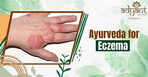 Best Ayurvedic Treatment For Eczema Ayurvedic Skin Doctor