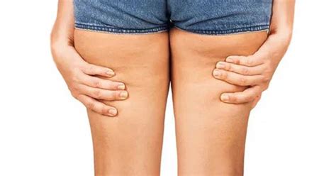 Thigh Lift Procedure Providers Photos Cost Belorens