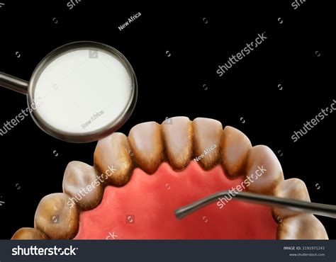 Examining Teeth Calculus On Black Background Stock Photo 2191971241 ...