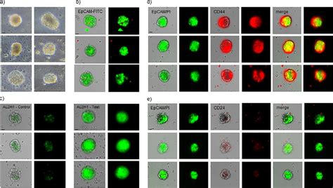 Typical Images Of Tumorspheres Grown In Vitro From Ccscs From One