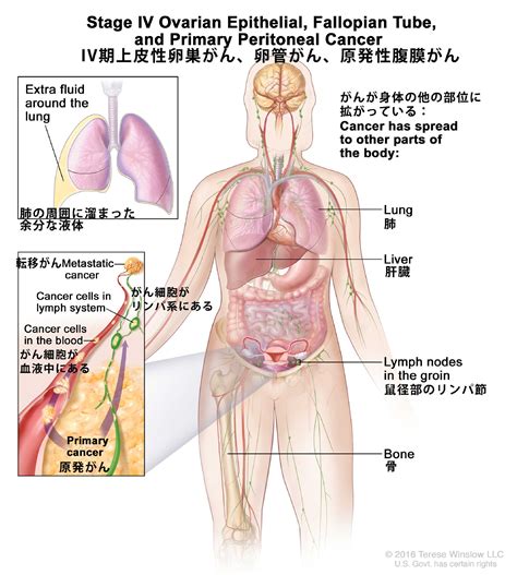 鼠径部 痛み 癌 女性 Hello Doctor