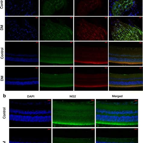 α Sma And Gfap Localization In The Mouse Optic Nerve And Retina And