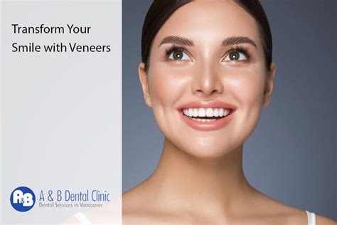 Transform Your Smile With Veneers Ab Dental Clinic