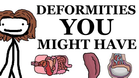 deformities