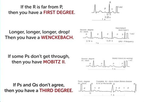 Heart Block Poem Emedicodiary