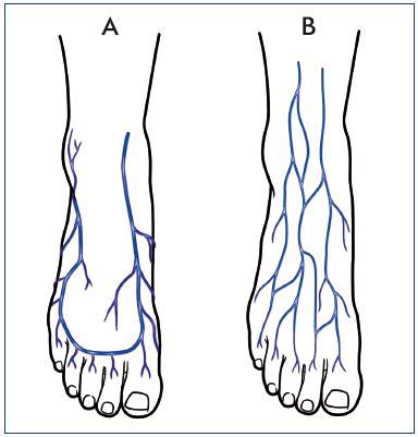 Foot Vein Anatomy - Anatomical Charts & Posters