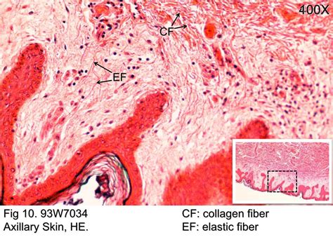 Elastic Fibers Em