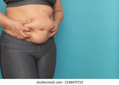 Naked Obese Woman Images Stock Photos Vectors Shutterstock