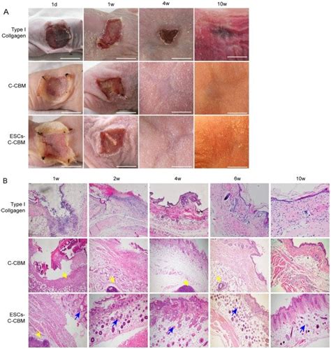 A Observation Of Nude Mice Full Thickness Defect Model Dressed With