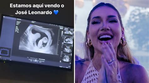 Virginia Mostra Ultrassom Do Terceiro Filho Tudo Perfeito CNN Brasil