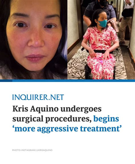INQUIRER.net - Kris Aquino revealed she recently underwent surgical
