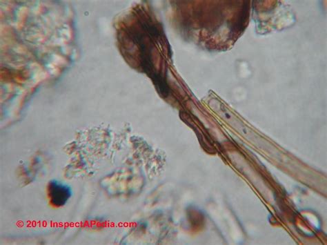 Mold Hyphal Fragments Are Hyphae A Sign Of Mold Contamination In