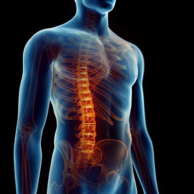 recovering  transverse myelitis demands  guided approach