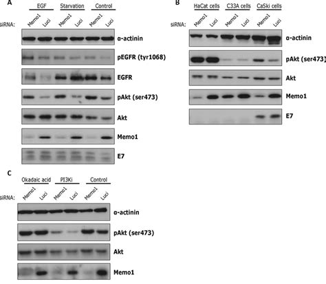 Memo1 Modulates Akt Activation In HPV Positive Cervical Cell Lines A