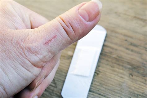 Wound Infection Stock Photos, Pictures & Royalty-Free Images - iStock