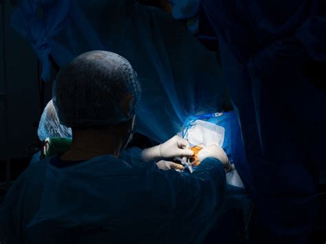 184 Anal Fissure Surgery Images Stock Photos 3D Objects Vectors