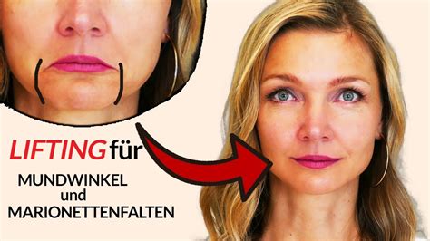 LIFTING für hängende Mundwinkel Marionettenfalten Botox Effekt