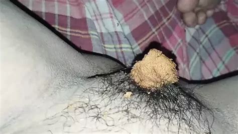 Schmutziger Anal Creampie Xhamster